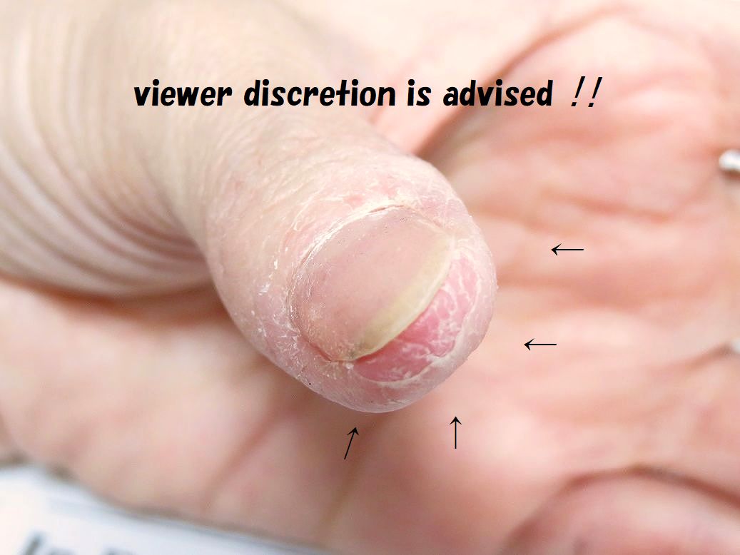 100均ダイソーの『指先用ばんそうこう』が優秀！ささくれにGOOD！エンジョイ子育て生活