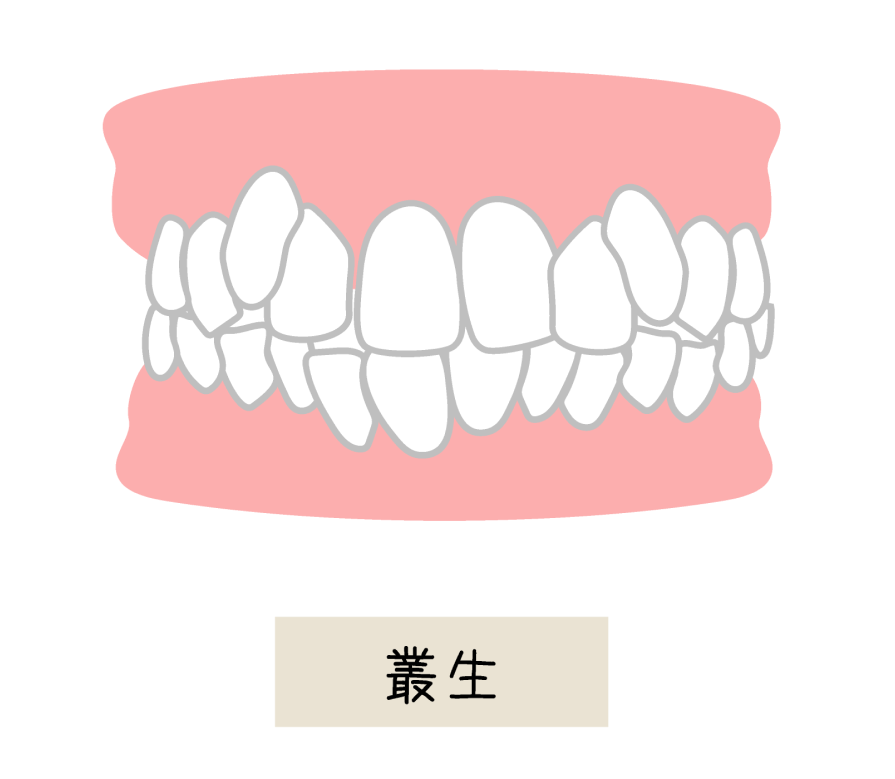 出会い系でセフレにした人妻5人ｗ美人ほどヤレる!