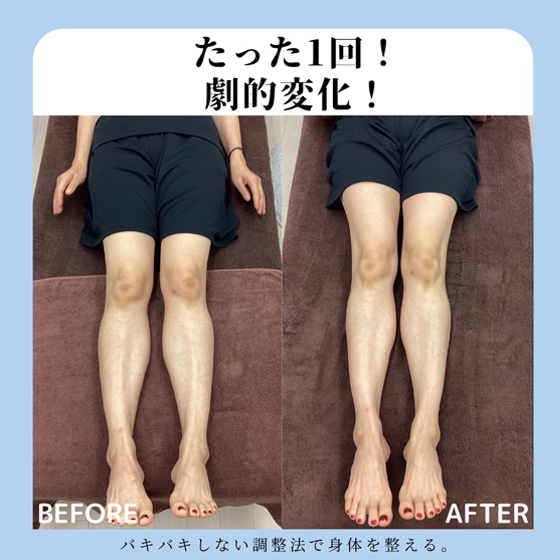足パカ 1ヶ月 ビフォーアフターTikTok