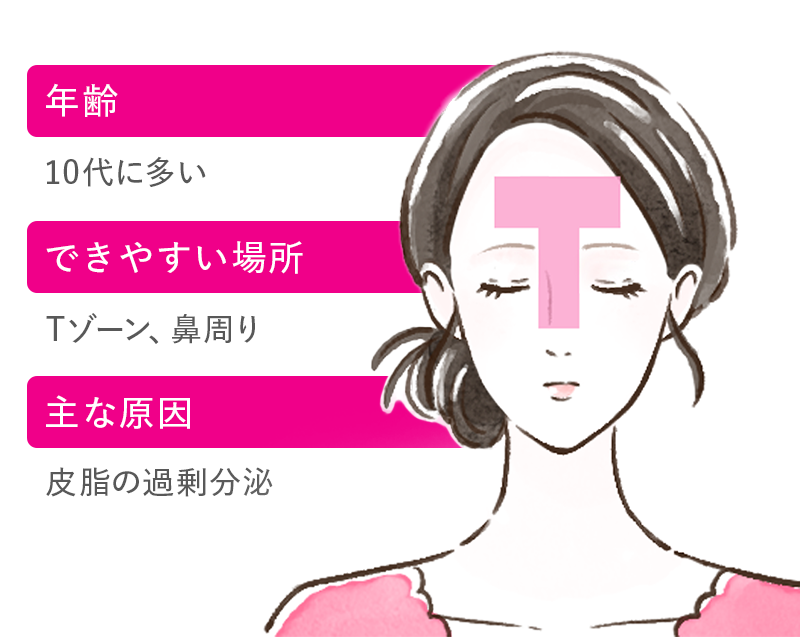 日焼け、ニキビ、テカり JKあるあるな肌悩みを解決！ 学校美容Q&ASeventeen-Web