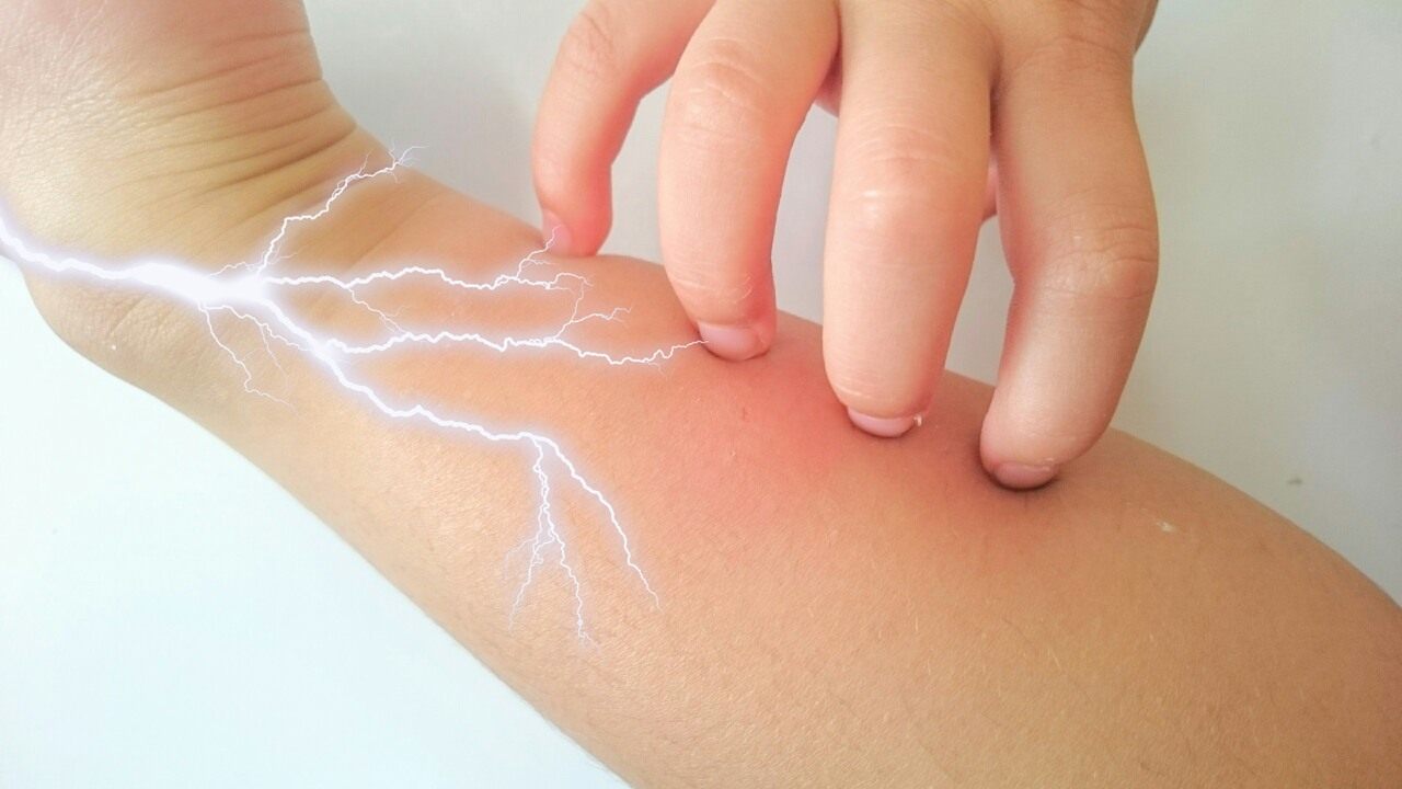 虫刺されの痕からわかる！よくある原因の虫と対処法〜皮膚科医が解説〜R形成外科皮膚科クリニック