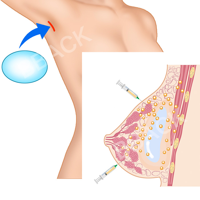 医療用シェーマ - STUDIO BIUM