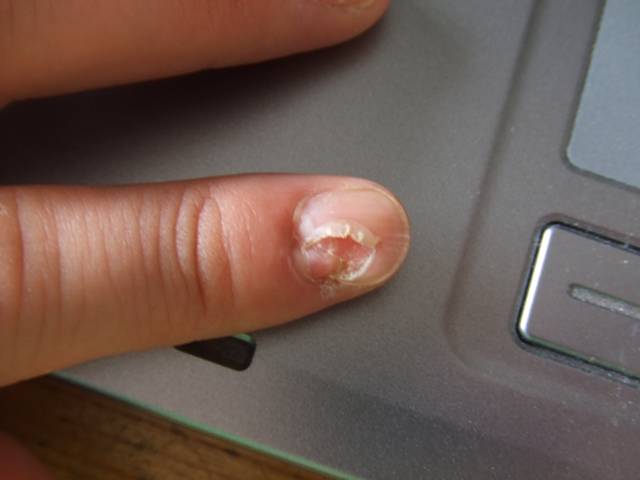 穴の空いたドアを直す