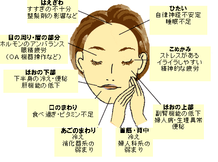 口周りニキビの原因と治し方、ケアは？ニキビ一緒に治そうProject製薬会社のマルホ