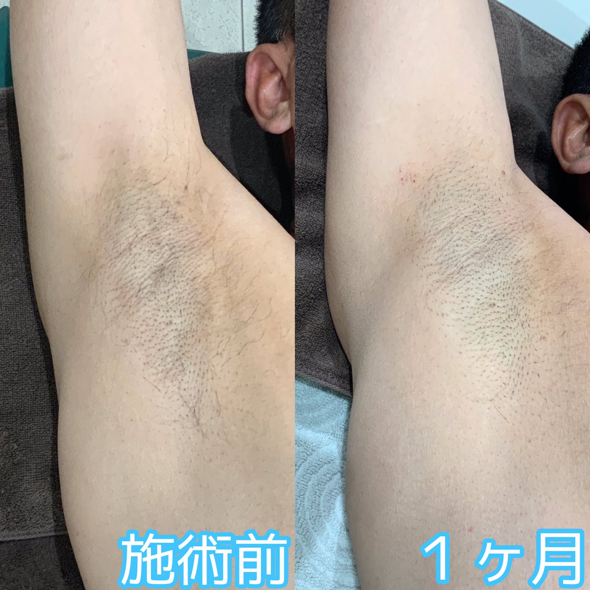 ブラウス 脇の汗じみ 黄ばみ