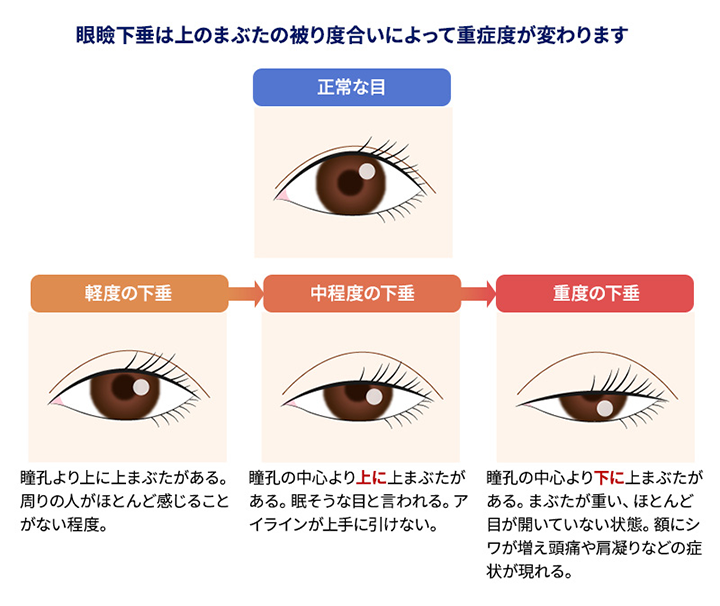 特殊な目 瞳 の描き方⑥ - 楽しくお絵かき空間