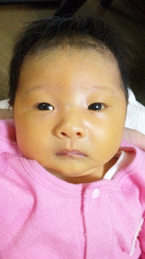 最新の知見に基づいた「黄疸計 JM-105」推奨使用法が日本新生児黄疸管理研究会によって公表されました新生児医療に無くてはならない存在にコニカミノルタ