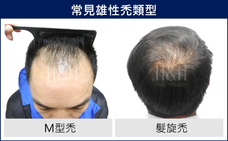 禿頭とくとう はげあたまtokutou hageatama 은 무슨 뜻인가요?-일본어 사전, 일본어 한국어