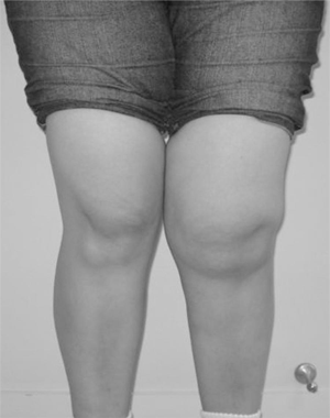 普段の生活が原因！？膝上の肉を撃退する方法！パーソナルトレーニング・完全個室パーソナルジムならかたぎり塾