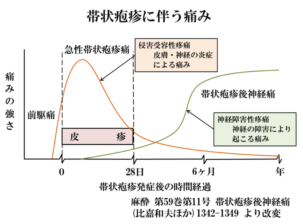 帯状疱疹診療の様子 - ビッグツリー練馬クリニック
