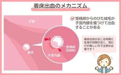 助産師が解説 着床出血と生理の違い！症状・見分け方のポイント┃まなべび