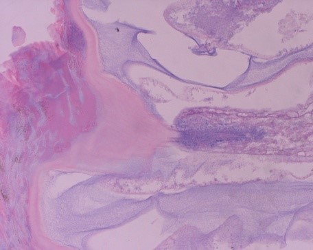 フジツボの怖い話は本当か考察！人間の足や膝に寄生するのは都市伝説？マジマジ情報局