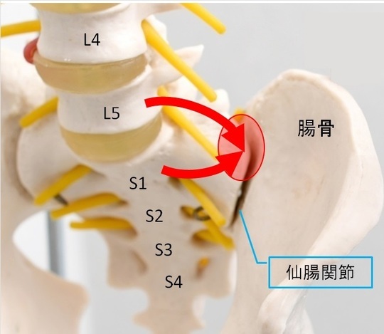 仙腸関節炎の原因と治し方 大網街道整骨院が徹底解説！大網街道整骨院