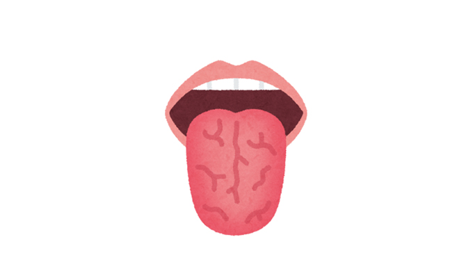 舌がひび割れるのはなぜ？原因や治療法を解説 - 武蔵中原の歯医者なら、中林デンタルケアークリニック武蔵中原駅徒歩5分の歯科医院