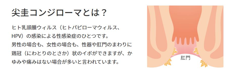 レーザー治療外来 - 診療コンテンツのご案内 - 目黒区の産婦人科、婦人科の専門医 田中レディスライフクリニック