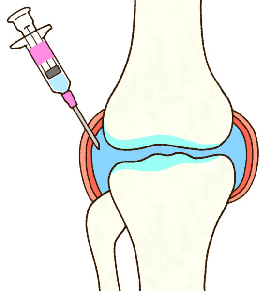 ベーカー嚢胞膝の整形外科医-学びの部屋