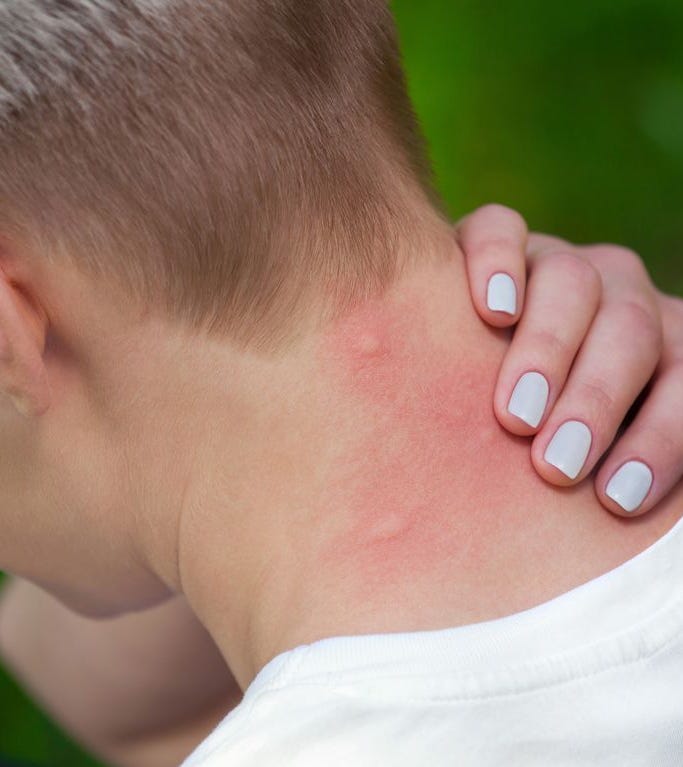 足野田市 小児科 千葉県 こどもの花粉症 こどもの漢方 喘息 アトピー性皮膚炎 アレルギー 結節性痒疹 たんぽぽこどもクリニック