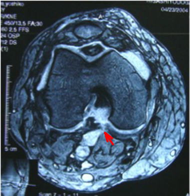 超音波検査大和市池田整形外科クリニック