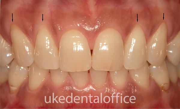 カジサック 5人目を妊娠中のヨメサック「泣いちゃいそう 」“育児”を赤裸々に語る＜AbemaTV＞『カジサックの笑顔でハイタッチ』ヨメサックインタビューフィールドキャスタ