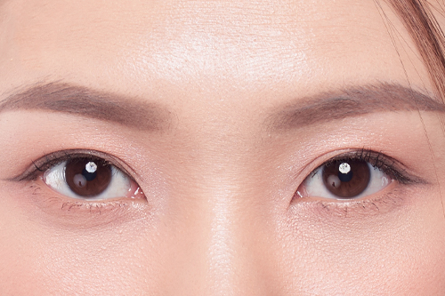 末広二重と平行二重の違いとは？整形で理想の二重にする方法について埋没法・二重整形の基礎知識東京イセアクリニック