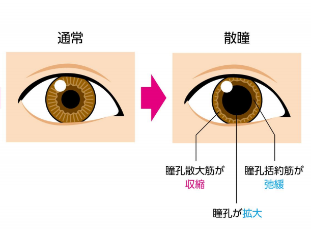 瞳孔を開く目薬を使わない眼底検査 散瞳薬を使わないたける眼科福岡市早良区 高取商店街 西新駅 藤崎駅