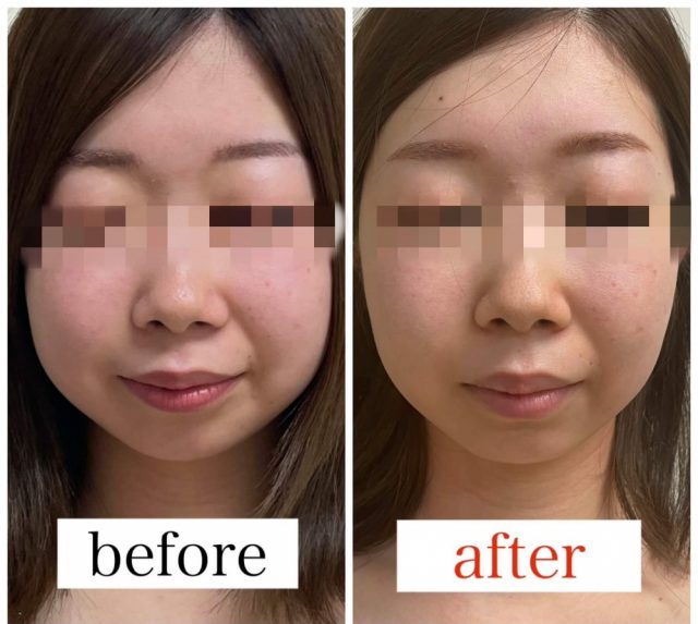 顔 浮腫まない 寝方TikTok