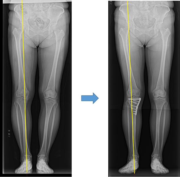 こんにちは、ヘッドミント南越谷店の蓮見です🌷ブログ埼玉県越谷のリラクゼーションならヘッドミント南越谷店