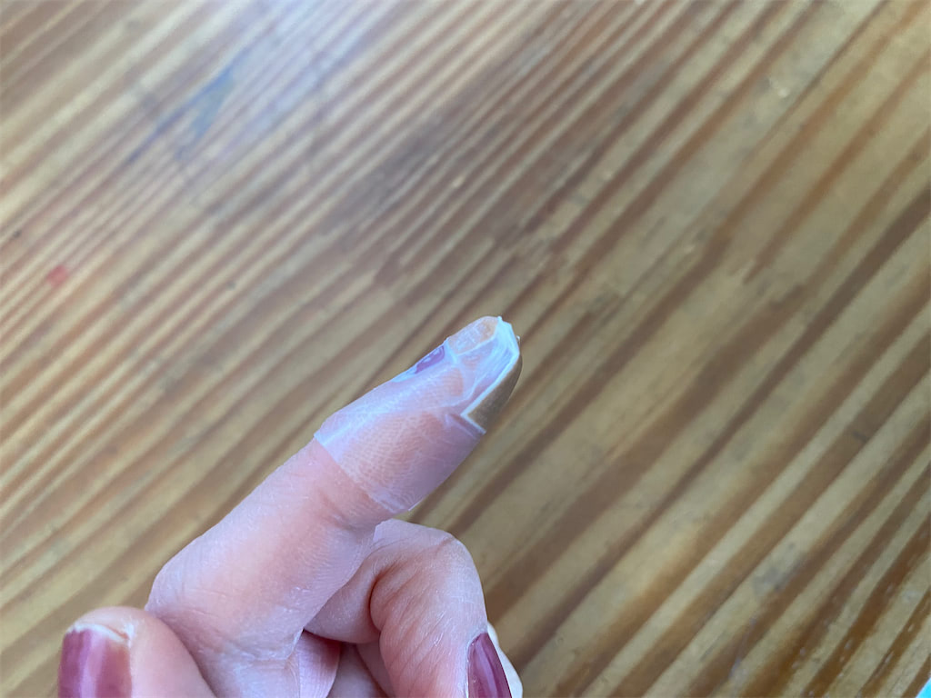 キズパワーパッドを貼って良い傷と貼ってダメな傷を皮膚科専門医が解説 - 東京・大阪の美容皮膚科ならFLALU フラルクリニック