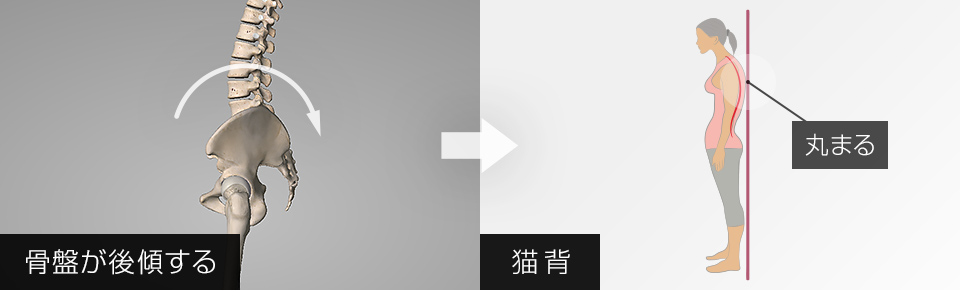 長座で骨盤後傾してしまうのをセルフで整えるプログラム骨盤立てる