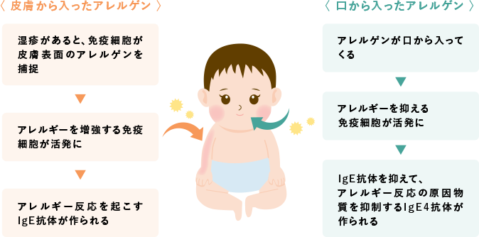 赤ちゃんの皮膚の病気 アトピー性皮膚炎の症状とケア 医師監修 たまひよ
