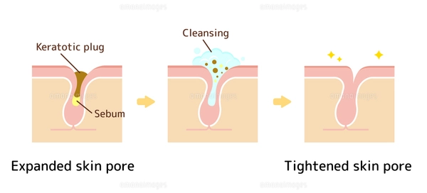 あなたの黒ずみ毛穴タイプをチェック！やってはいけないNGケア・正しい毛穴ケア方法を解説celllavie