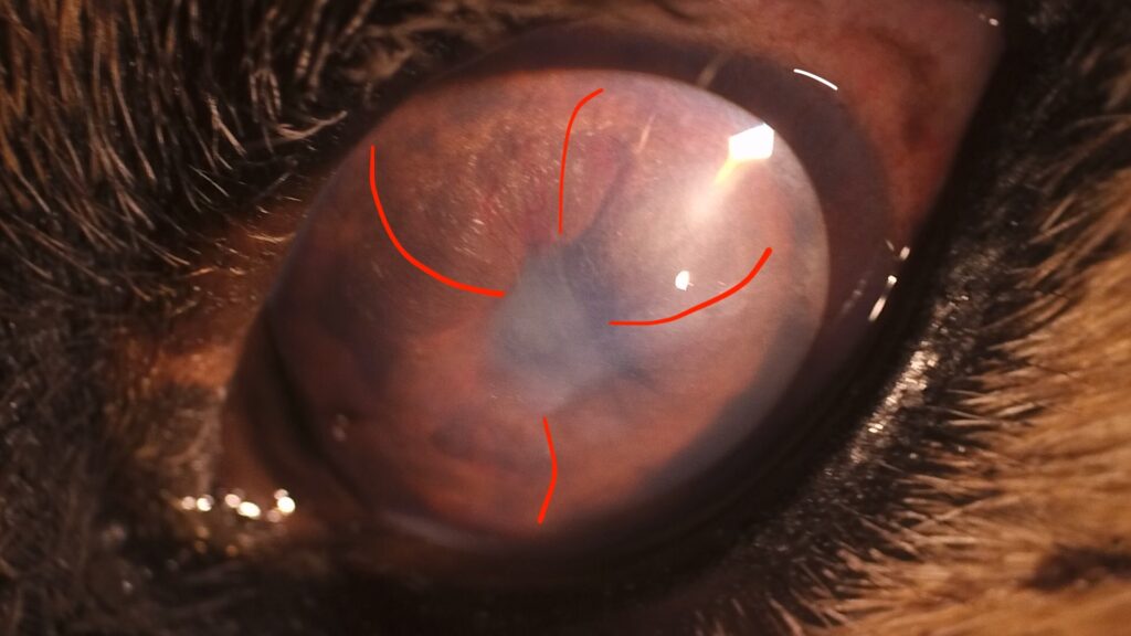 ぶどう膜炎 - 新川崎眼科川崎市幸区北加瀬