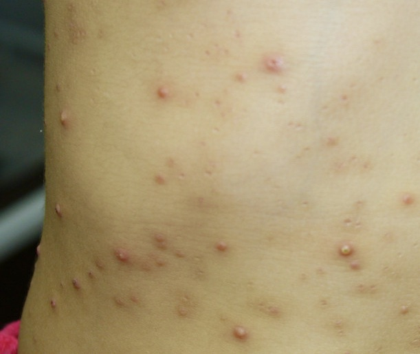 健康と病気・医療・医薬の情報プラットホームメディカルテラス