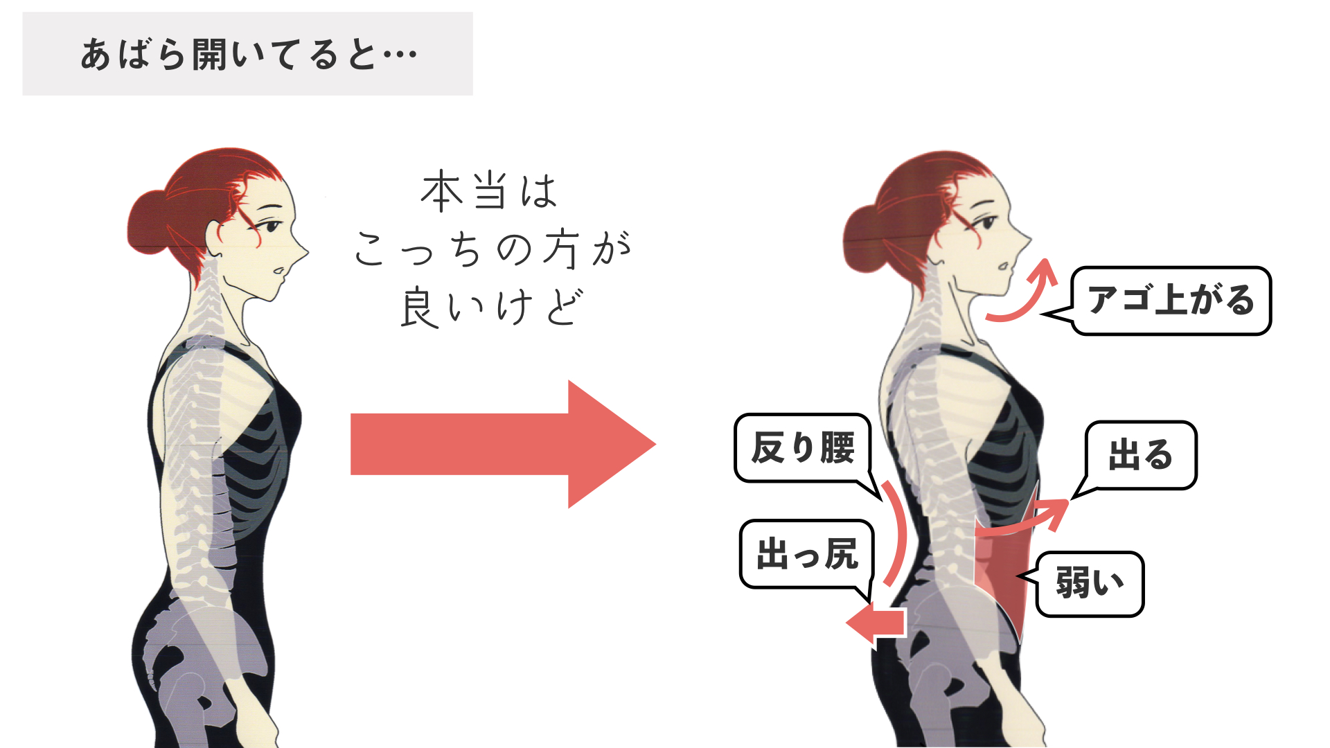 肋骨が開く とは ？肋骨 が開いている なんて表現がありますが、それがどういった状態をさすのかは意外とバラバラです。共通する点は呼吸の仕方に癖があるということ。 その癖がどういったものかをしっかりと把握すれば 肋骨締め なんて必要ないですよ。 息の吸い方の