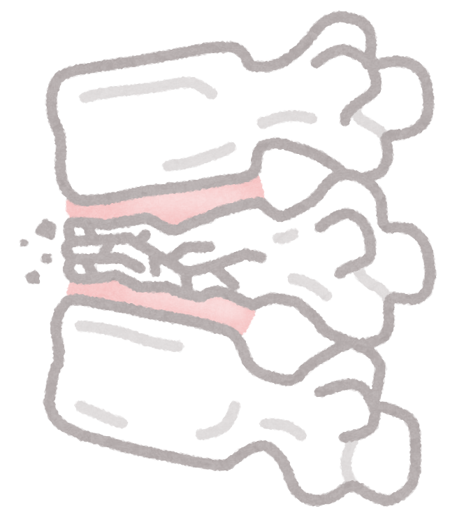 足を骨折した子供 男の子 の無料 フリー イラストかわいい手描きの無料素材「てがきっず」保育園・小学校・介護施設にぴったりのフリー素材イラスト