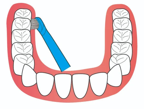 突然、歯ぐきが腫れた！知っておきたい８つの原因と対処法精密根管治療専門の岡野歯科医院