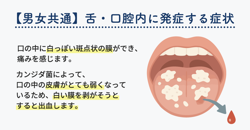 口の中の病変よく見られる大人の病気 - みやけ内科・循環器科 家庭の医学