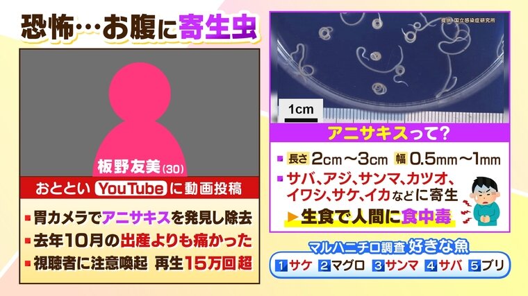 刺身を食べた後の腹痛はアニサキス食中毒かも。早めの胃カメラを。江東区「東大島駅」の苦痛のない胃・大腸カメラ、日帰りポリープ切除・肛門科手術