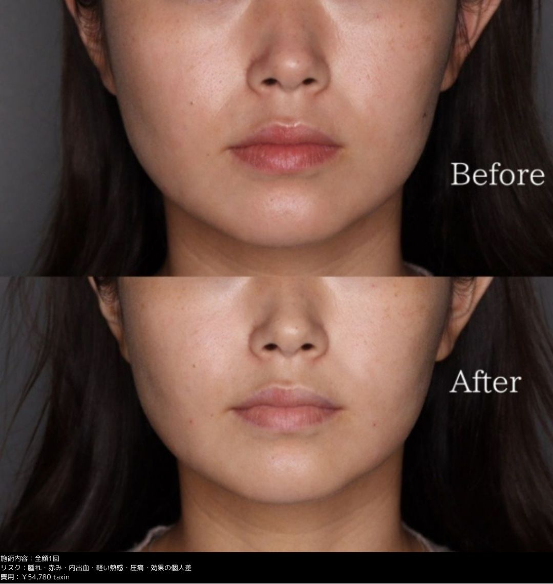 垢抜けたいなら“顔の余白をなくす”が近道！ 吉田朱里式・美人見えのコツマキアオンライン美容雑誌『MAQUIA マキア 』公式ビューティサイト