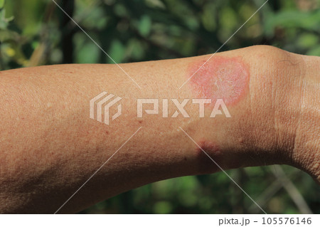 刺す毛虫５ マツカレハ 庭の刺す毛虫・刺さない毛虫 -- 公益社団法人農林水産・食品産業技術振興協会