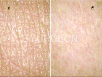 肌のキメって復活するの？ – ヒト骨髄幹細胞のエイジングケアマックスエクセレント