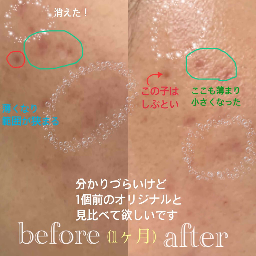 The Ordinaryジオーディナリー 初心者が買うべきおすすめ7選！ - HEY SISTER