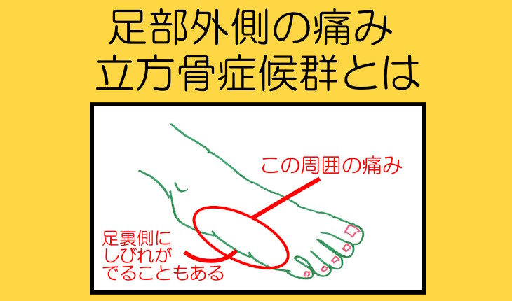 豆状骨骨折 転んで手をついてから、てのひらが痛い！- 古東整形外科・リウマチ科