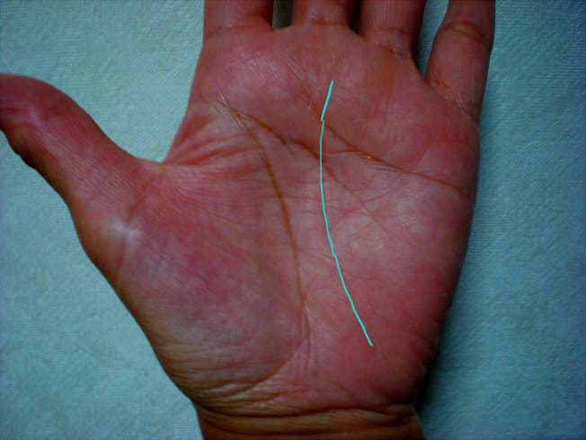 tesou_ya_fortun←過去投稿はこちら 今回は投稿を見ていただきありがとうございます‼ 今回は「ご先祖様強く守られる手相2選」をご紹介しました!!ーーーーーーーご先祖様強く守られる手相2選ご先祖様に 強く守られている人には どんな手相があるのか 今回は ご先祖