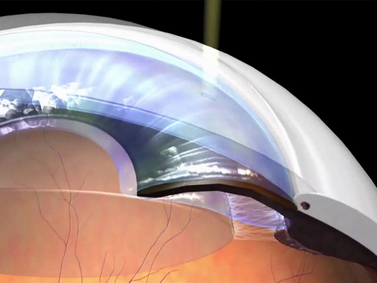 河村藤吉画伯の眼病図譜│九州大学医学部 眼科