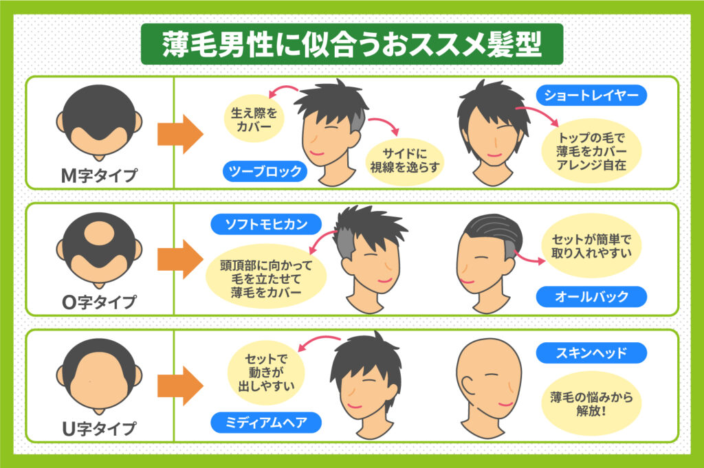 メンズ向け 薄毛が目立たない髪型を紹介！ショートなどかっこいいヘアスタイルを厳選 薄毛に悩む男性の為の美容室ならRELIVE - 薄毛 に悩む男性のための完全個室美容室