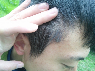 一人でみれるもん。BPPV。~診療攻略~ 良性発作性頭位めまい症救急医の頭ん中