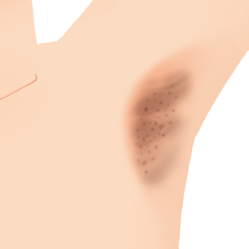 たった40秒で首コリがラクになる！ 村木宏衣さん考案 脇の下ほぐしPrecious.jp プレシャス