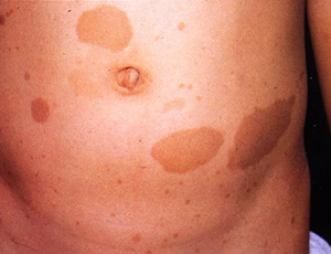 ピアニスト解剖 １ アレクシス・ワイセンベルク内藤 晃