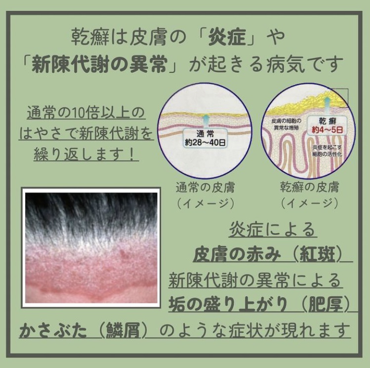 乾癬 かんせん について乾癬 尋常性乾癬、乾癬性関節炎、膿疱性乾癬 の患者さん向けコセンティクス®を使用される患者さんへノバルティスファーマ株式会社